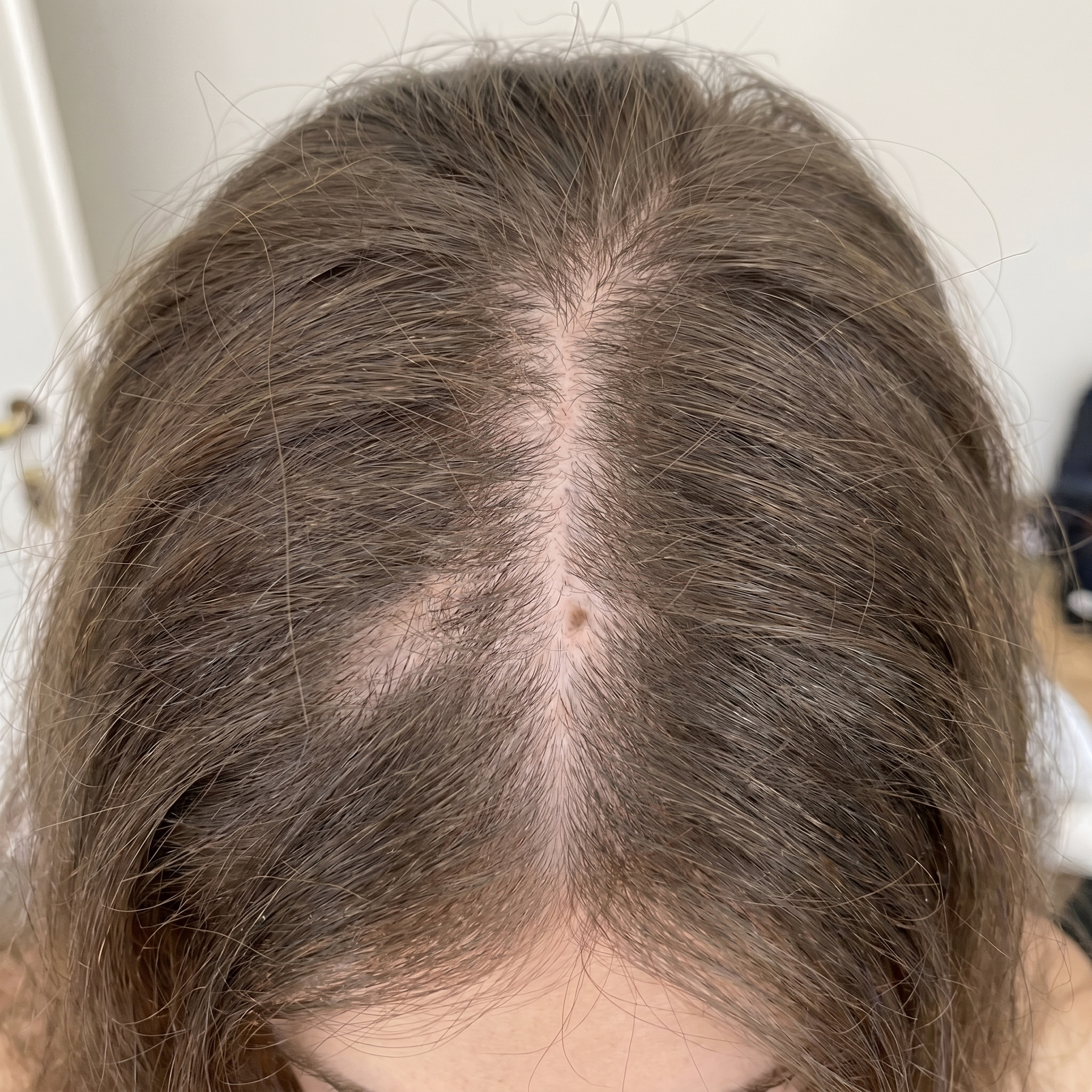 Before