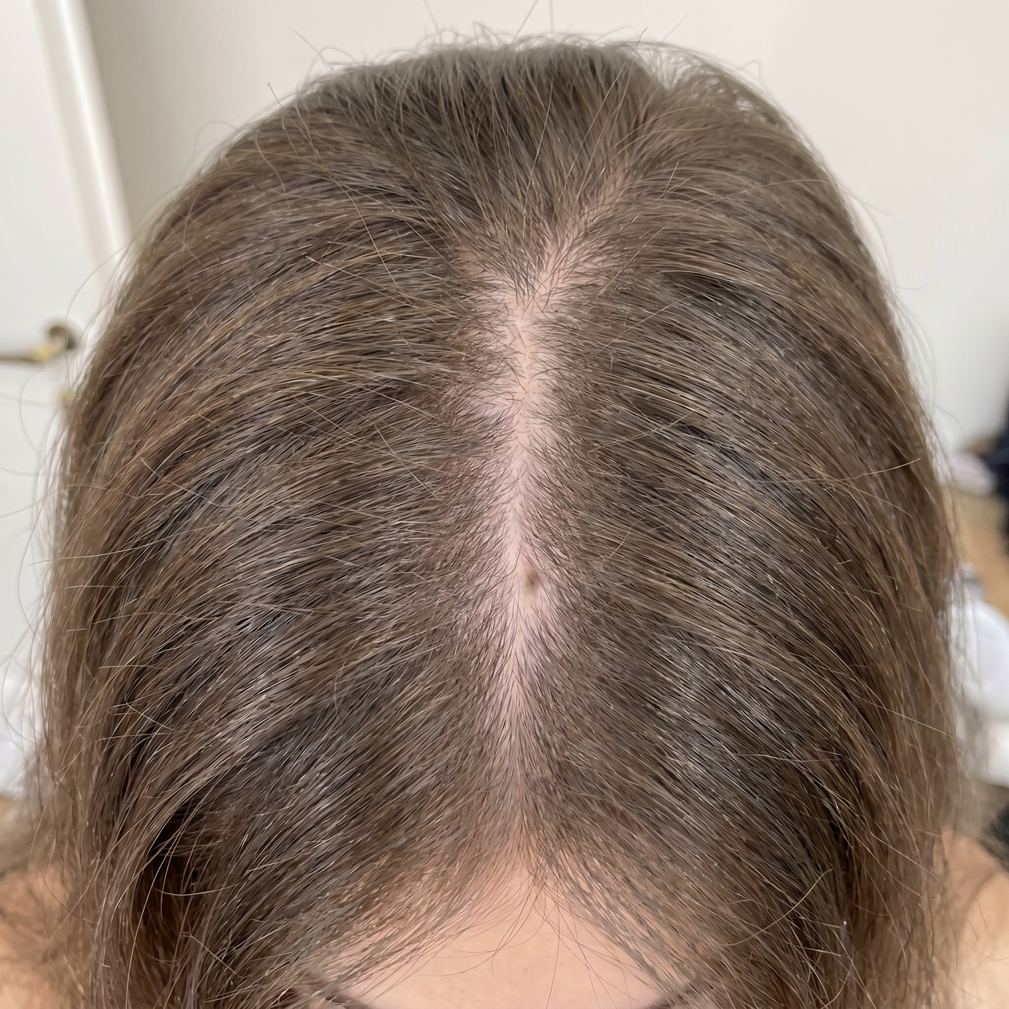 After